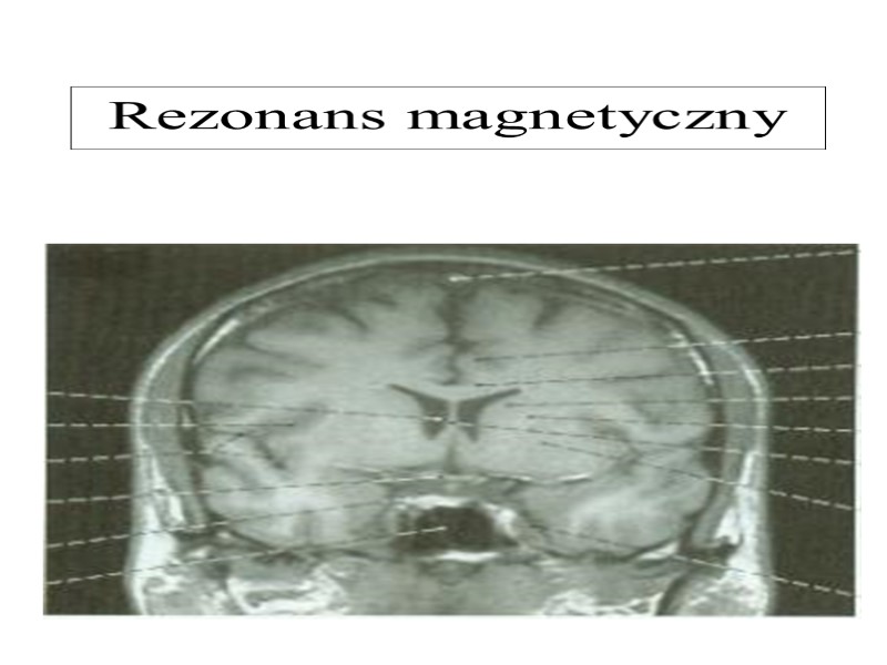 Rezonans magnetyczny